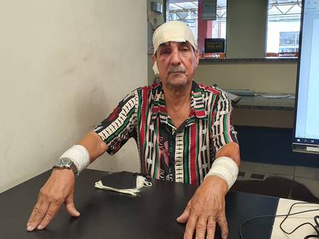 O motorista de ônibus Luiz Carlos Ribeiro teve ferimentos na cabeça e nos braços provocados por socos dados por Leonardo Costa Nogueira