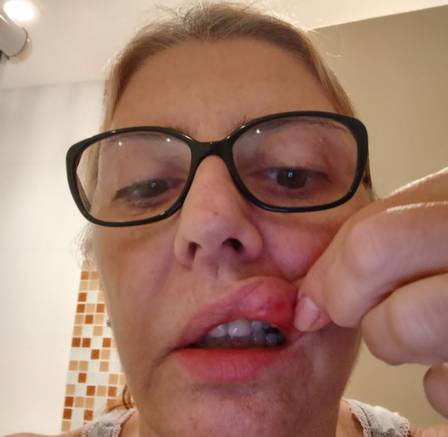 Síndica Dayse de Souza Ribeiro mostra a boca ferida