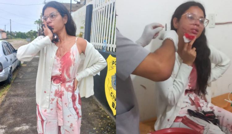 Jovem com corte no rosto
