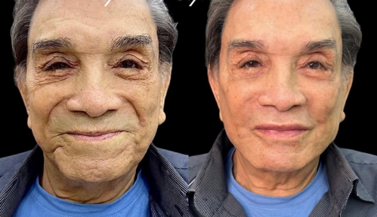 Antes e depois de Dedé Santana