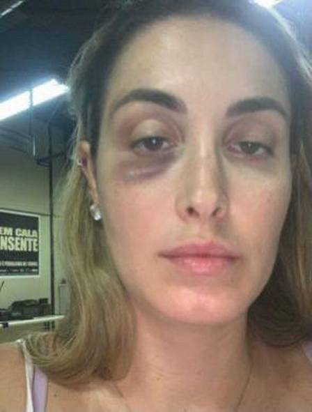 Patrícia de Paiva Reis, em foto publicada nas redes sociais em campanha contra a violência doméstica