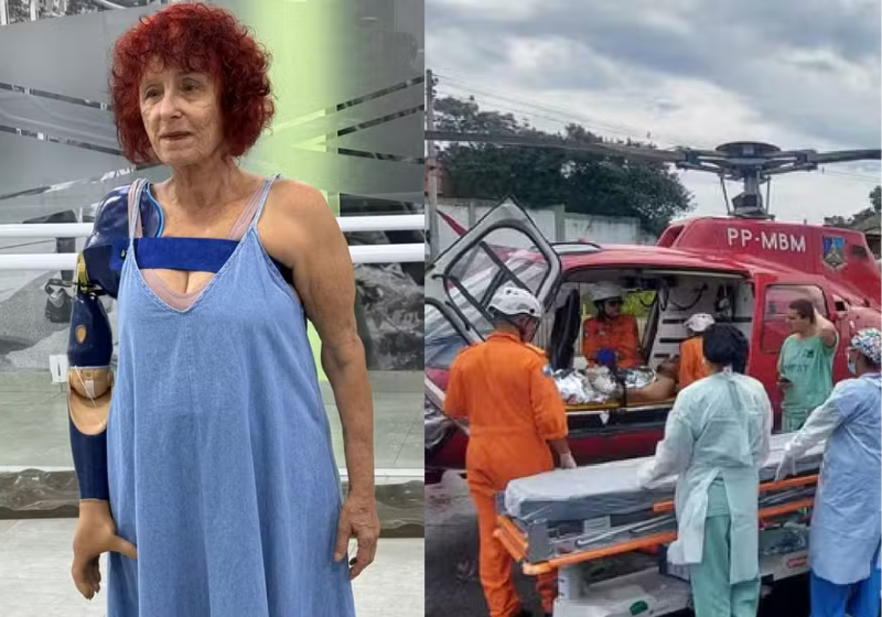 Roseana Murray usa prótese biônica pela primeira vez após ataque de pitbulls Roseana Murray, de Saquarema, conseguiu uma prótese biônica para retomar a rotina como escritora. - Foto: Arquivo pessoal