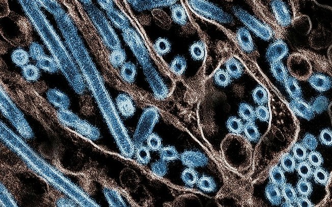 Imagem cortesia do Centro Nacional de Controle e Prevenção de Doenças dos Estados Unidos (CDC) e do Instituto Nacional de Alergias e Doenças Infecciosas em 22 de novembro de 2024 mostra  uma imagem microscópica colorizada de partículas do vírus H5N1 (em azul)