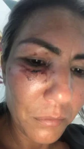 SAQUAREMA: Corrida de app vira pancadaria com barra de ferro e polícia na mira