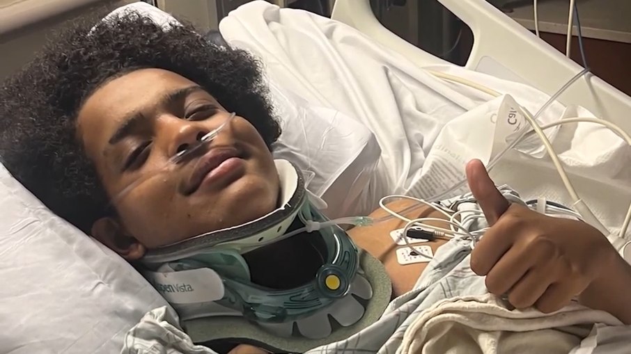 Yassin Khalifa, de 15 anos, sobreviveu após ser atingido por raio