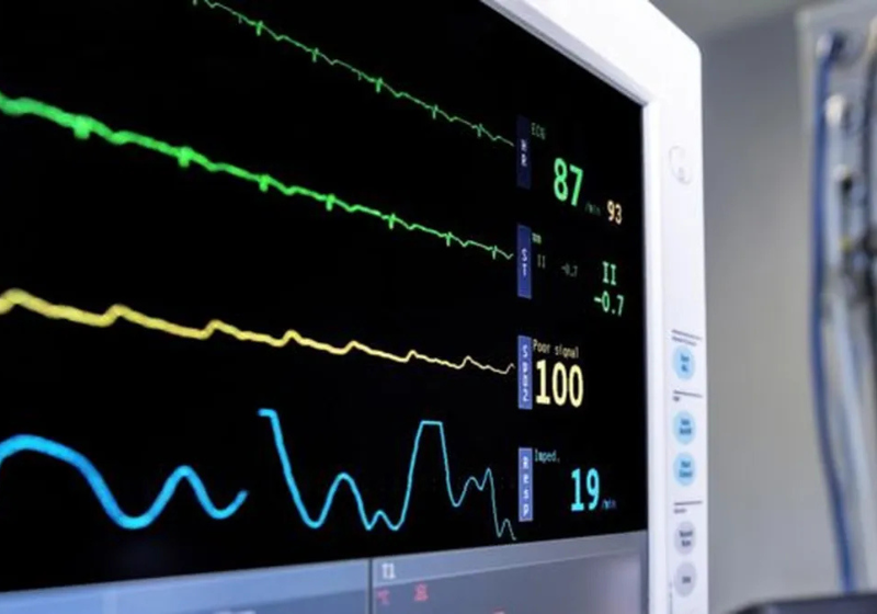 Microscópio com IA detecta infarto e AVC antes de acontecerem; criado no Japão O microscópio com inteligência artificial (IA), de Tóquio, ajuda a prevenir AVC e infarto. - Foto: Getty Images