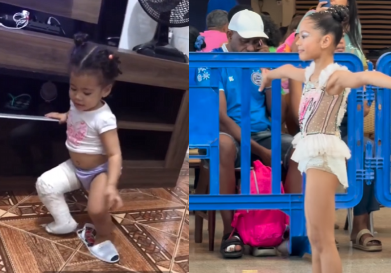 Garotinha que nasceu com deficiência no pé se torna ginasta e emociona; vídeo A garotinha Melinda, da Bahia, nasceu com deficiência no pé, se superou e virou uma ginasta linda. - Foto: @melindakahena/Instagram