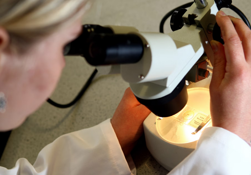 Nova terapia contra câncer de estômago aumenta sobrevida em 40% A nova terapia chinesa, usa células modificadas para tratar o câncer de estômago e foi publicada na revista The Lancet. - Foto: David Davies/PA