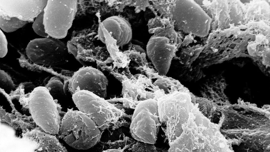 Yersinia pestis, bactéria que causa a peste Yersinia pestis, bactéria que causa a peste
