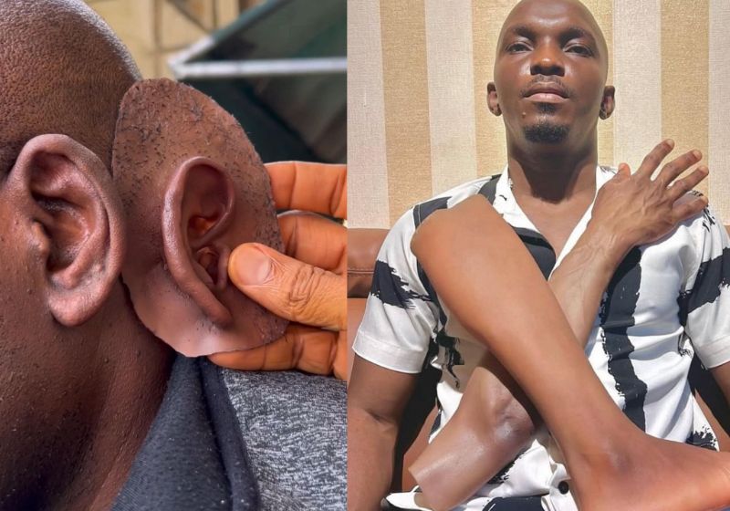 Artista inova com próteses para pessoas pretas e transforma vidas; vídeo John Amanam, artista da Nigéria que faz próteses realistas para pessoas pretas, teve a ideia depois que uma pessoa da família perdeu um dedo e não havia nada na cor dela. - Foto: @john_amanam