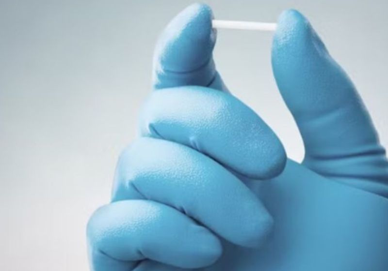Como é o novo implante contraceptivo de R$ 4 mil que o SUS vai oferecer a mulheres O novo implante contraceptivo Implanon, oferecido de forma gratuita pelo SUS, funciona durante 3 anos.- Foto: divulgação