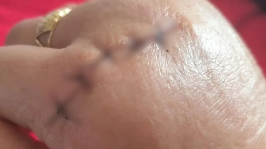 Aluna ataca professora com golpes de faca Aluna ataca professora com golpes de faca