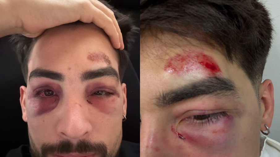 Donizete Oliveira expõe agressão em sua rede social