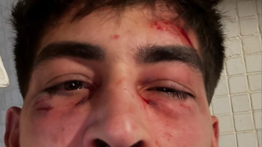 Donizete Oliveira expõe agressão em sua rede social