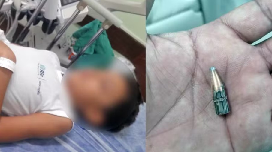 Menino é atingido por tiro durante aula de educação física
