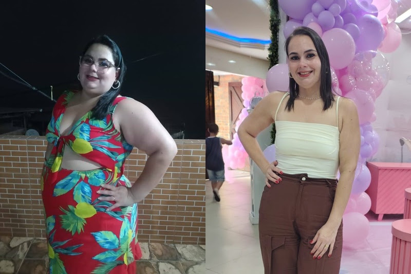 Cirurgia bariátrica mantém alta procura no Rio de Janeiro mesmo na era das “canetas” emagrecedoras Cirurgia bariátrica mantém alta procura no Rio de Janeiro mesmo na era das “canetas” emagrecedoras