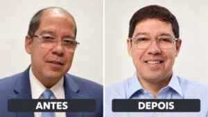 oposição diz que São Gonçalo tem coisa cabeluda, mas é só o novo visual de Altineu Côrtes depois do implante capilar